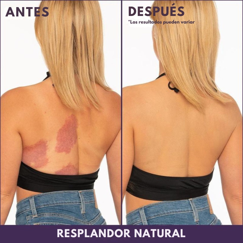 Perfeccionador de Cobertura Corporal