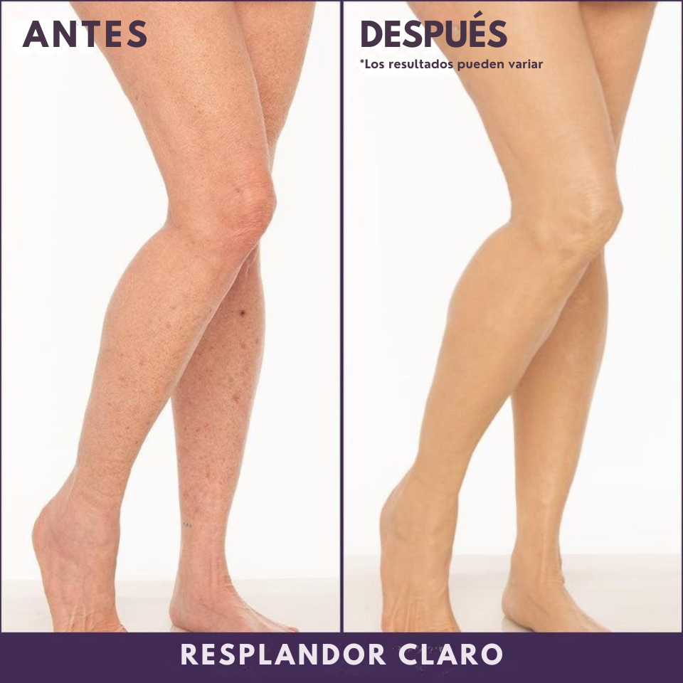 Perfeccionador de Cobertura Corporal